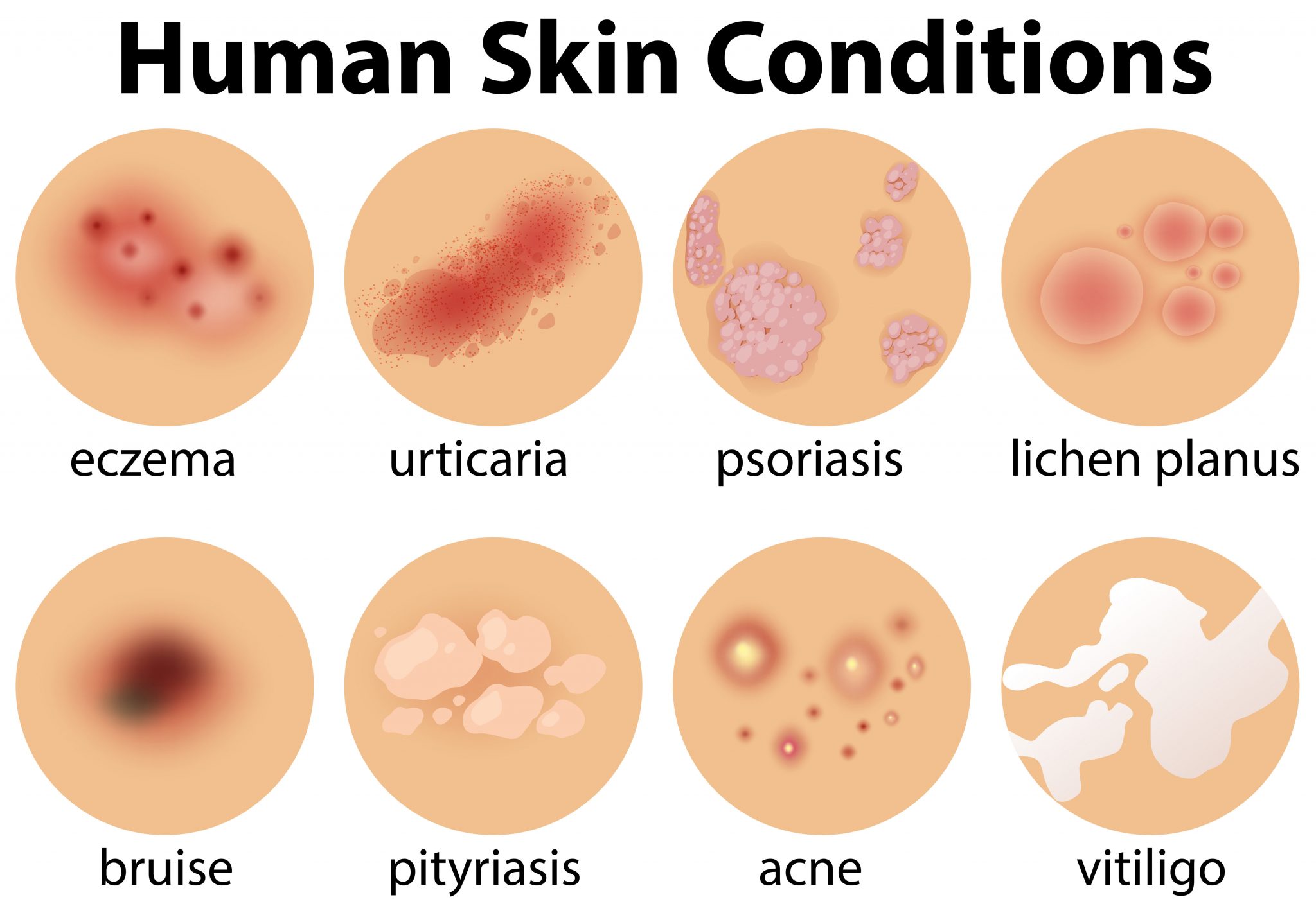 How to recognise skin concerns, conditions and infections. - Rainbow TLC